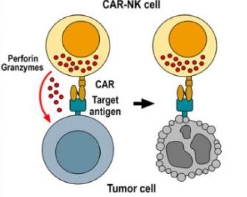 CAR-NK細(xì)胞