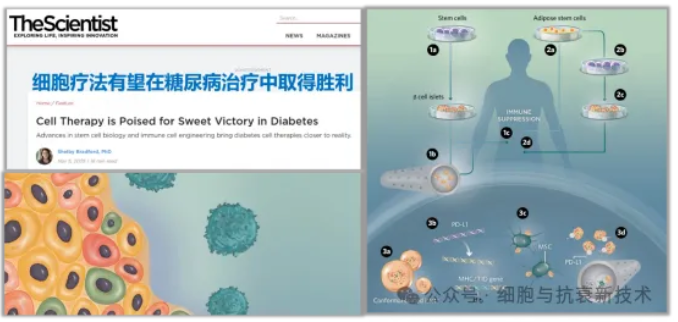 細(xì)胞療法有望在糖尿病治療中取得勝利